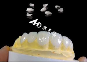 China Translucencys IPS Emax Veneers , Minimal Preparation Emax Dental Veneers wholesale