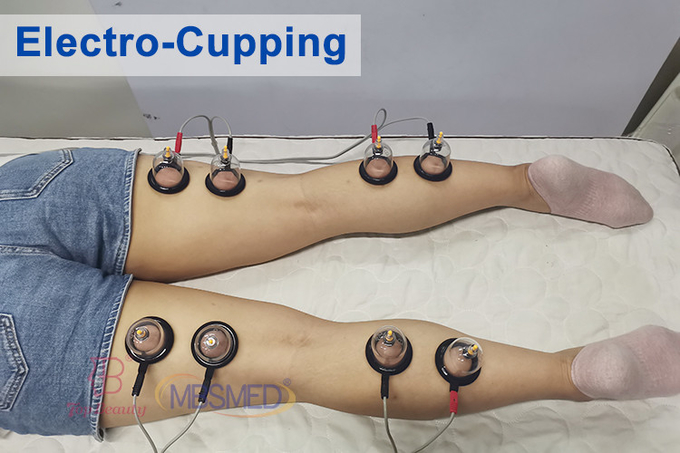 Electrotherapy Tens Pain Relief Sport Electro Muscle Stimulation Machine