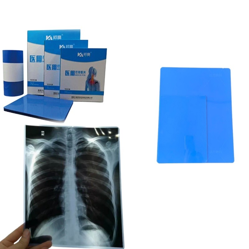 Medical X-Ray/CT/DR Dry Scan Film For X-Ray Laser Image Printer And Thermal Image Printer Equipment
