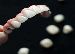 China Aesthetic Solution Dental Implant Crown Bridge For Adults Replacing Missing Teeth wholesale