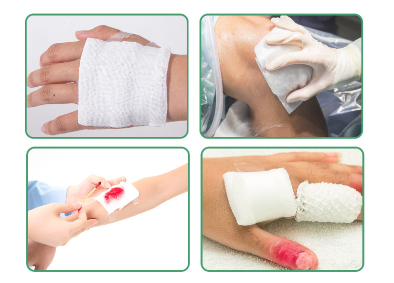 Non Sterile Wounds Surgical Gauze Sponges Swab Gauze Dressing