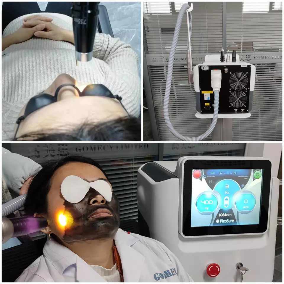 Multifunctional Picosecond Hollywood Diamond Carbon Peeling Sking Rejuvenation