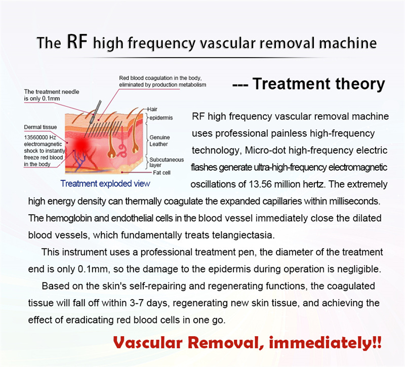 Painless Vascular Laser Spider Vein Removal Machine Diode Portable 980nm 60W