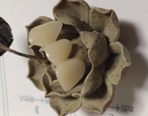 China Natural Colour Resin Based Composite Crowns wholesale