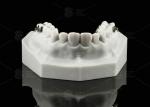 Children And Adolescents Quad Helix Appliance Orthodontics Stainless Steel