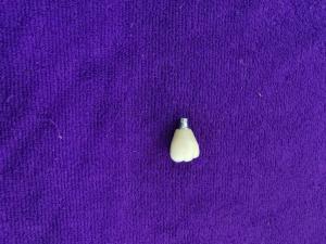 China Single Tooth Trushine OSSETEM Dental Implants Fixture Level wholesale