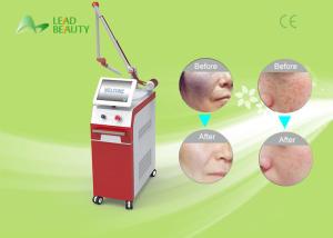 China professional Q-Switch ND YAG laser tattoo removal machine with high power wholesale