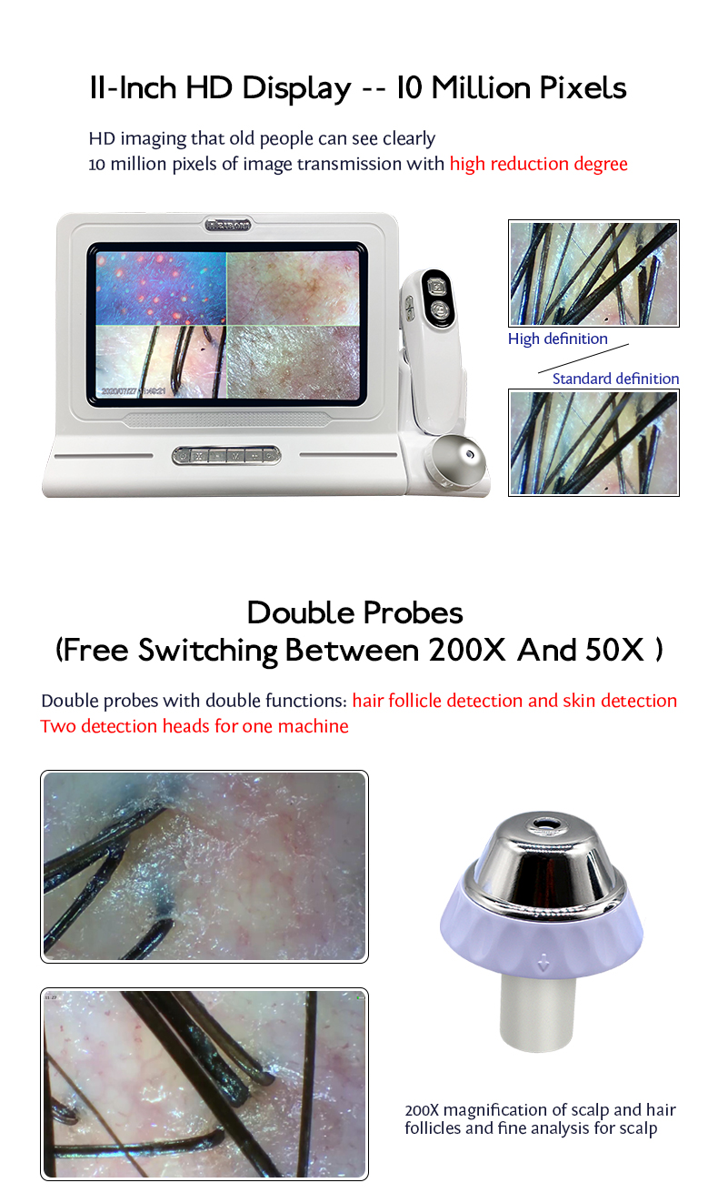 HD Touch Screen Portable Hair and Scalp Analyzer for Hair Scanner Analysis Machine