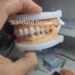 Perfect Esthetics Provisional Wax Up for Dental Professionals using dental wax