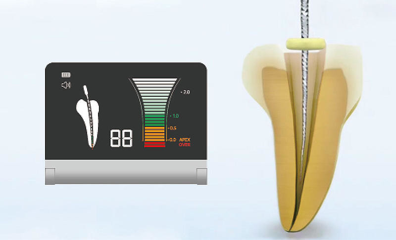 Aluminum Alloy Apex Locator Endo Motor 50-60Hz For Root Canal Treatment