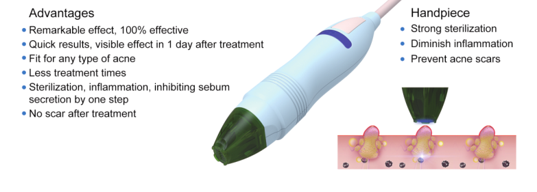 Scan Scar RF Acne Treatment Machine Ultraviolet Rays Micro Needle