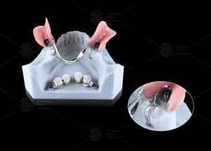 China 0.1mm Tolerance CEKA REVAX Attachment Titanium 3mm Vertical Clearance wholesale