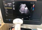 Philip C5-1 Abdominal Medical Ultrasound Probe For EPIQ 5 device