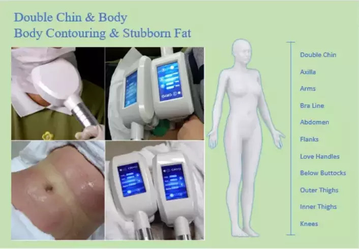 7 Handles 40khz Cavitation Multipolar Rf Ultrasonic Body Slimming Machine