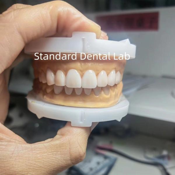 Perfect Esthetics Provisional Wax Up for Dental Professionals using dental wax