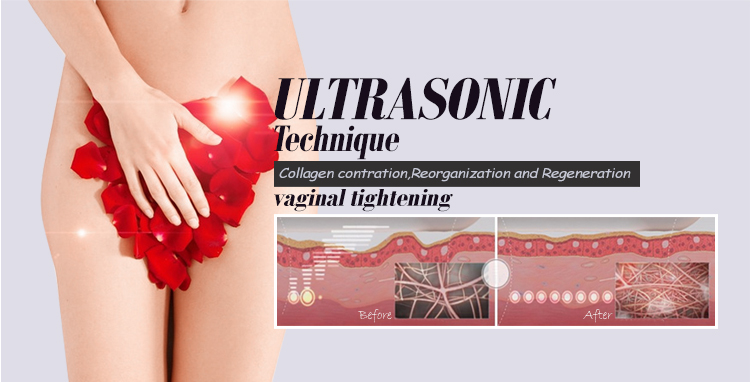 High Intensity Focused Ultrasound Machine 2 in 1 Facial Anti Wrinkle