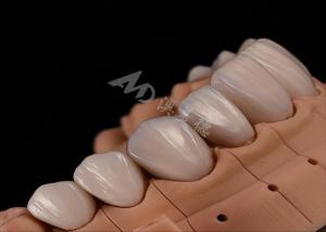 China Strength Natural Esthetics Teeth Zirconia Crowns For Precise Fit Chip Resistance wholesale