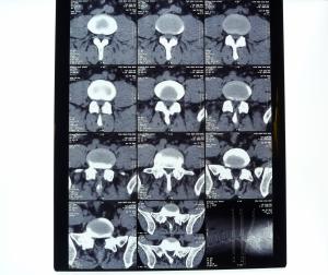 China White PET AGFA Medical Dry Film wholesale