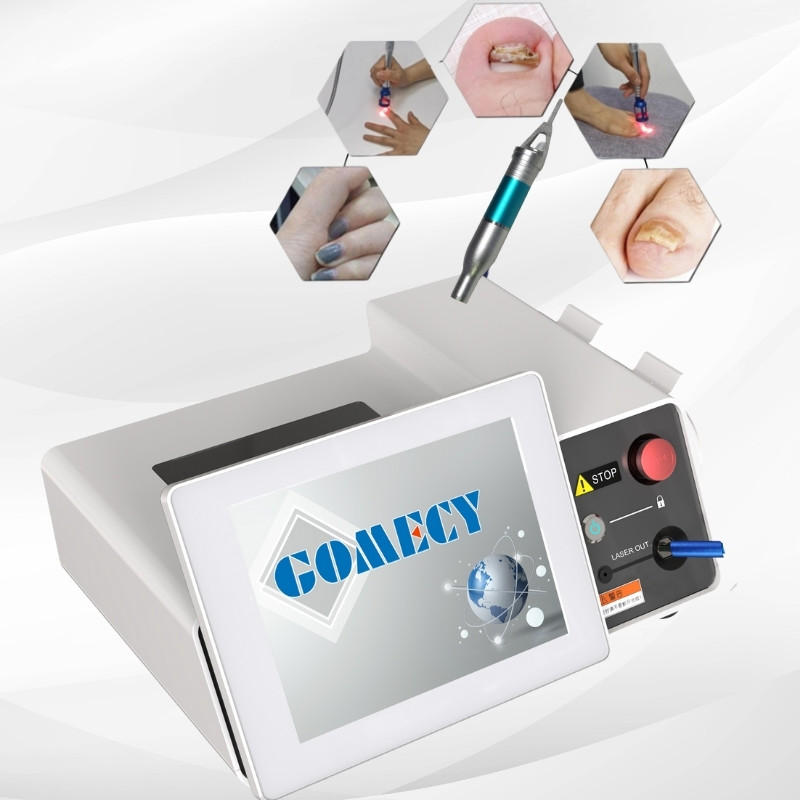 Gomecy 980nm Diode Laser Physiotherapy Machine Blue Light Therapy Pen Varicose Veins Laser Treatment Laser for Nails With Fungus