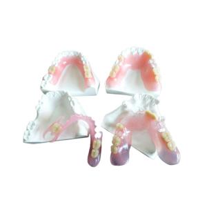China Digital PFM Dental Crown Restoration wholesale