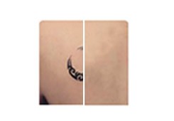 Picosecond Laser Tattoo Removal Equipment , Nd Yag Laser Equipment High Energy