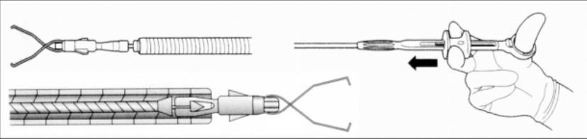 Single-use endoscopic rotatable hemoclips