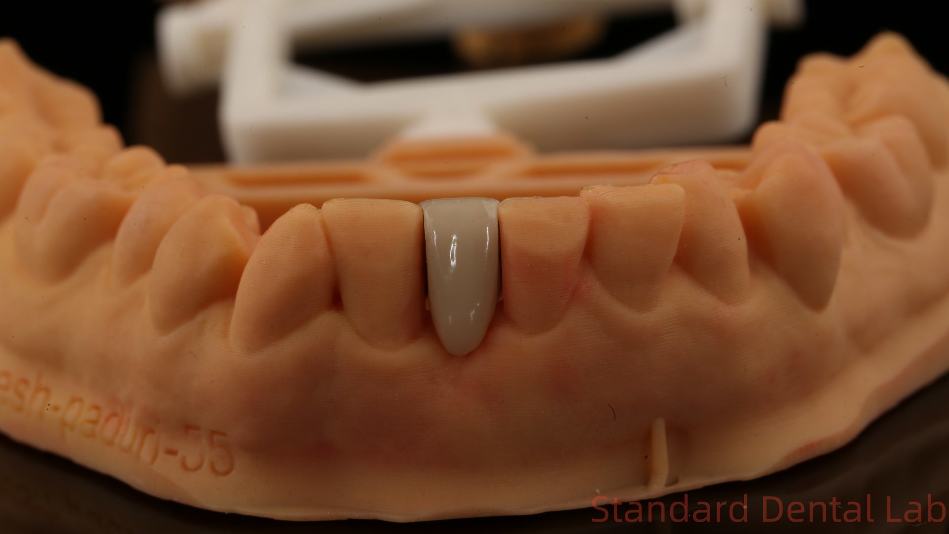 Dental PFM Maryland Bridge High Esthetics FDA Certified With Vita Porcelian China Dental Lab