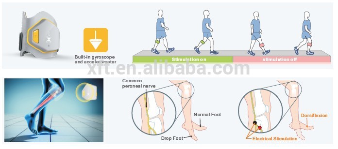 Light weight FES drop foot treatment stimulator for foot drop
