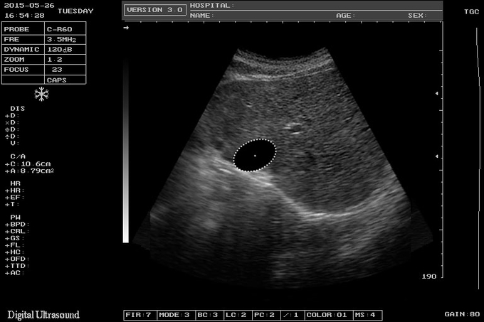 ISO Electron Scan Notebook USG Scan Machine For Obstetrics And Gynecology 8