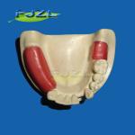 dental implant material bone graft implant model