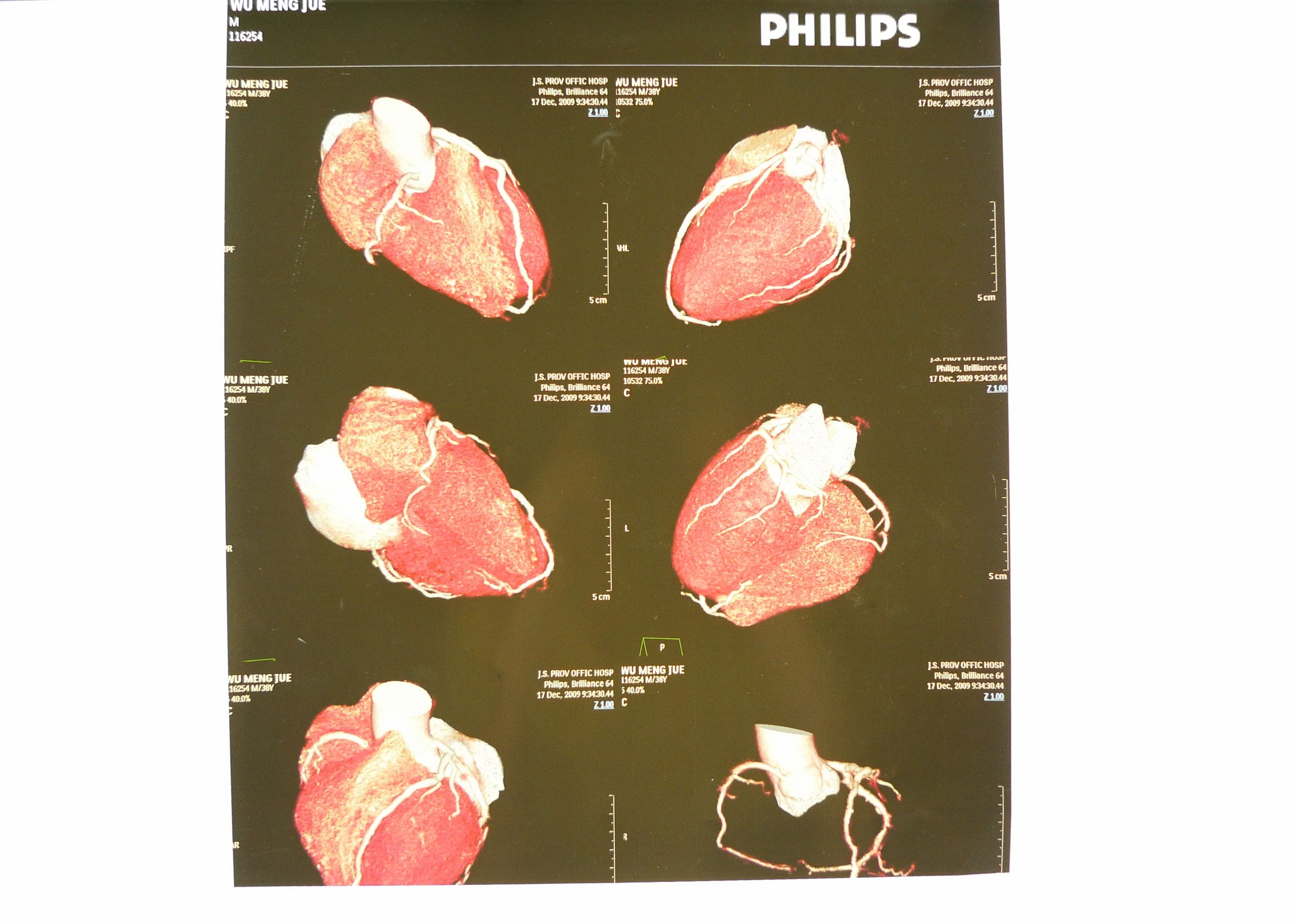 Hosipital PET Film Medical X Ray Paper Waterproof 8 ×10 Inch CT Film White