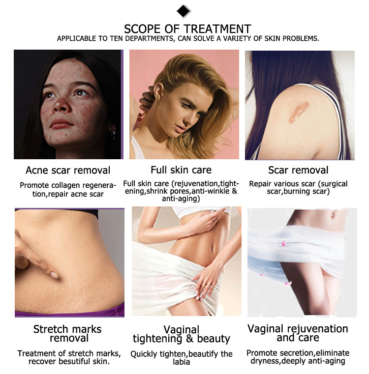 Medical Aesthetic Use Best Resurfacing Fractional Co2 Laser Skin Tightening Machine