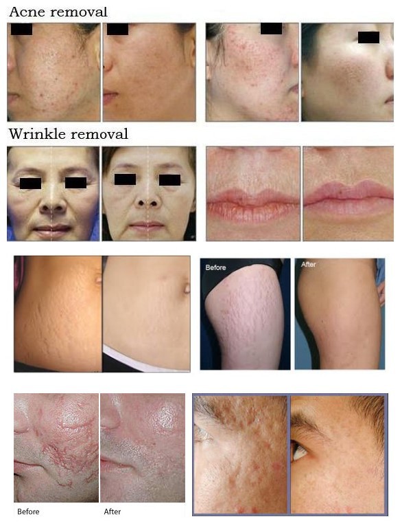 before-after pics.jpg