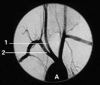 China Konida Medical X Ray Films wholesale