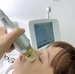 Body Collagen Induction 220V Microneedling Fractional RF