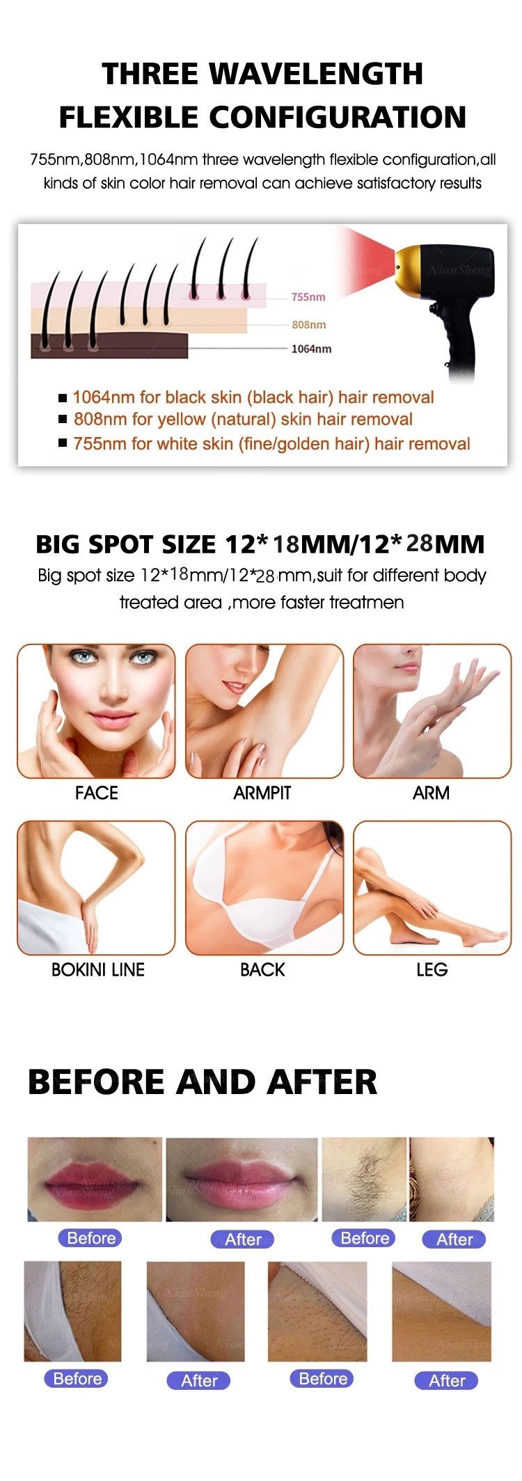 Ice Speed L 3 Wavelength Oem Commercial 808 Diode Laser Hair Removal Machine