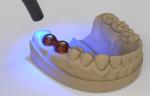 OEM 12ml Light Cure Adhesive Dental Composite Resin