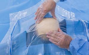 China Medical Sterile Craniotomy Drape Surgical With Aperture 1pc / Pouch wholesale