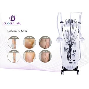 Body Sculpting Cryolipolysis Machine Wind / Water And Semiconductor Cooling