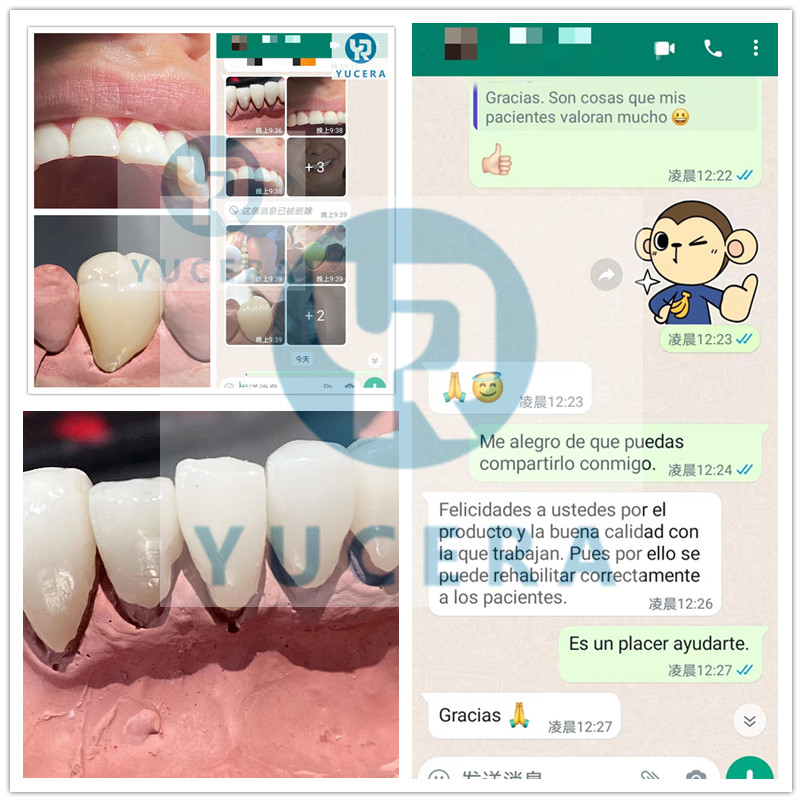 Yucera 4D-Multilayer 4D Pro Multilayer Zirconia Disc Disk Block CAD CAM Dental Laboratory Super Translucent 98mm