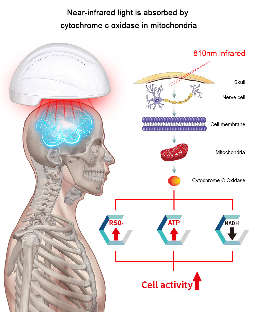 810nm Near Infrared Photobiomodulation Belt Brain Therapy Wrap Improve Memory