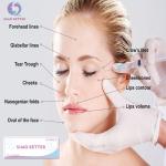 Adult Hyaluronic Acid Fillers Cannula Long Lasting Injectable Lip Fillers