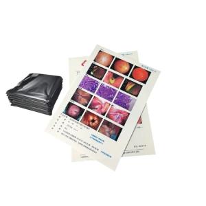 China 14x17 laser x-ray film FUJI DI-HL (14x17&quot;) / (35x43cm) Medical Laser Film fuji dry film wholesale