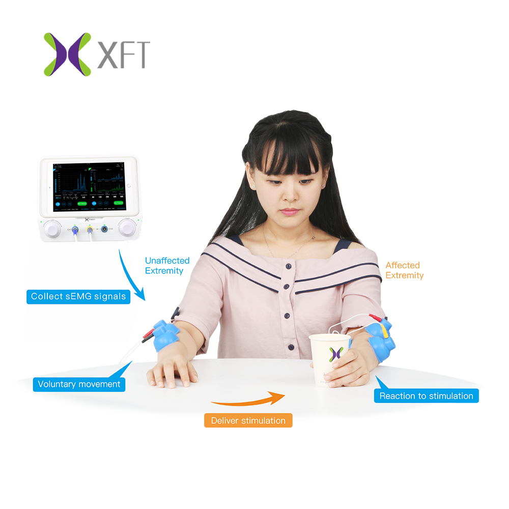 Surface EMG Functional Electrical Stimulation Machine