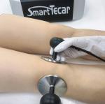 300KHz CET RET Tecar Therapy Machine Energy Potential Pain Relief Energy
