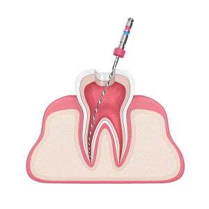 China BS Blue Storm Rotary Root Canal Files Dental Endo Files wholesale