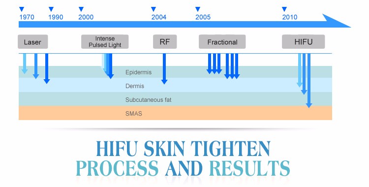 hifu facial Best anti wrinkle machine hifu product CE certifications approval