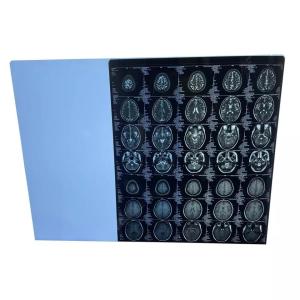 China Anti Static Medical Dry Film Fuji Laser Imaging Film 25cmx35cm wholesale