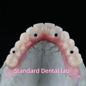 China Porcelain Zirconia Dental Implant Bridge Professional High Esthetics With Pink Gum wholesale