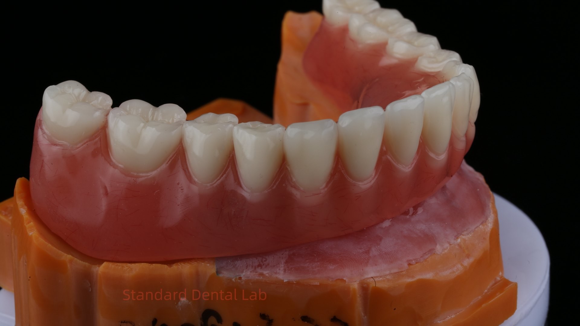 Ivoclar Digital Dental Implant Bar Denture with Attachments Full Acrylic Denture Titanium Implant Supported Dentures